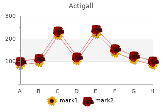 discount actigall 300 mg with amex