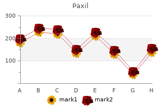 order 20 mg paxil otc