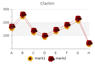 buy 10 mg claritin