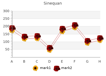 order 10mg sinequan amex