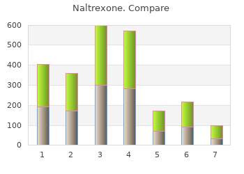 order naltrexone 50mg on line