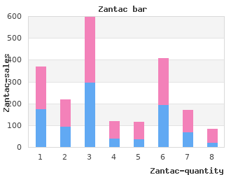 buy 150 mg zantac amex