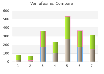 buy cheap venlafaxine 150 mg line