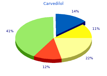 cheap 25 mg carvedilol fast delivery